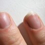 finger_nails