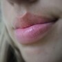 lips